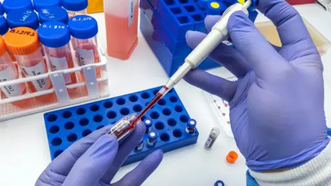 Getty Images Blood testing with dozens of vials of blood in the background and someone's gloved hands in the foreground removing blood from a vial with a pipette style device